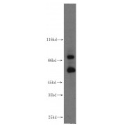 WB analysis of MCF7 cells, using MMP2 antibody (1/1000 dilution).