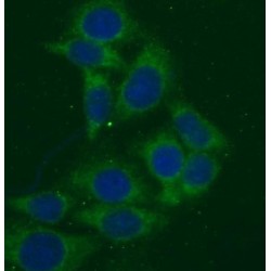 Matrix Metalloproteinase 23B (MMP23B) Antibody