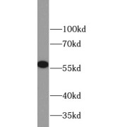 WB analysis of A549 cells, using MMP23B antibody (1/500 dilution).