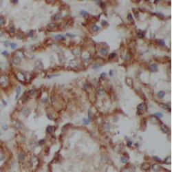 Matrix Metalloproteinase 28 (MMP28) Antibody