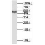 WB analysis of A549 cells, using MMP28 antibody (1/500 dilution).