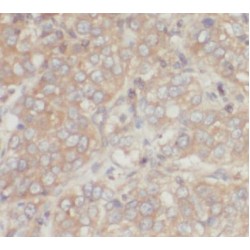 Matrix Metalloproteinase 3 / Stromelysin-1 (MMP3) Antibody