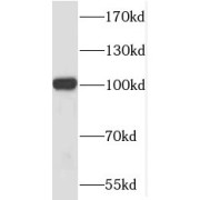 WB analysis of human brain tissue, using MMS19 antibody (1/500 dilution).