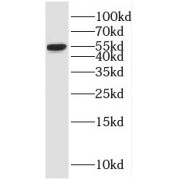 WB analysis of K-562 cells, using MNDA antibody (1/1000 dilution).