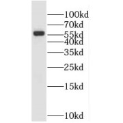 WB analysis of rat testis tissue, using MNS1 antibody (1/1000 dilution).