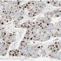 MOB Kinase Activator 1B (MOBKL1A) Antibody