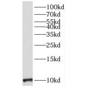 WB analysis of mouse brain tissue, using MOBP antibody (1/500 dilution).