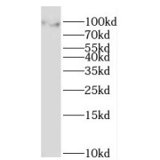 WB analysis of HepG2 cells, using MOCOS antibody (1/300 dilution).