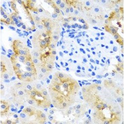 MAPK/MAK/MRK Overlapping Kinase (MOK) Antibody