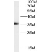 WB analysis of mouse liver tissue, using MOSC2 antibody (1/1000 dilution).