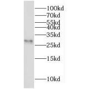 WB analysis of mouse testis tissue, using MOSPD3 antibody (1/600 dilution).