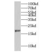 WB analysis of MCF7 cells, using MPHOSPH6 antibody (1/300 dilution).