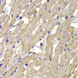 Mannose Phosphate Isomerase (MPI) Antibody