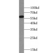 WB analysis of HeLa cells, using MPO antibody (1/600 dilution).