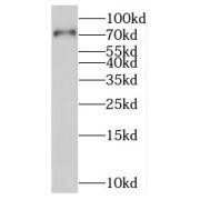 WB analysis of Y79 cells, using MPP5 antibody (1/400 dilution).