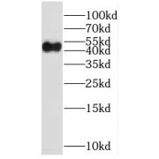 WB analysis of mouse brain tissue, using MPPE1 antibody (1/300 dilution).