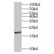 WB analysis of mouse kidney tissue, using MPV17 antibody (1/500 dilution).