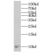 WB analysis of mouse kidney tissue, using MPV17L antibody (1/1000 dilution).