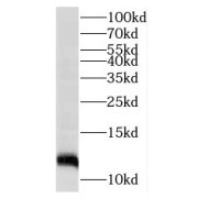 WB analysis of human kidney tissue, using MRAP antibody (1/300 dilution).