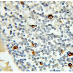 MRE11 Homolog, Double Strand Break Repair Nuclease (MRE11) Antibody