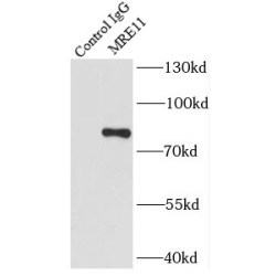 MRE11 Homolog, Double Strand Break Repair Nuclease (MRE11) Antibody