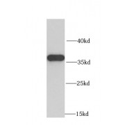 WB analysis of human liver tissue, using MRPL1 antibody (1/1000 dilution).