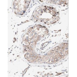 Mitochondrial Ribosomal Protein L10 (MRPL10) Antibody