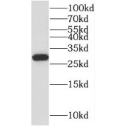 WB analysis of HEK-293 cells, using MRPL10 antibody (1/500 dilution).