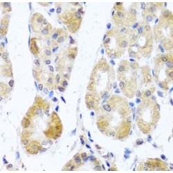 Mitochondrial Ribosomal Protein L11 (MRPL11) Antibody