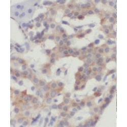 Mitochondrial Ribosomal Protein L14 (MRPL14) Antibody