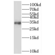 WB analysis of MCF7 cells, using MRPL15 antibody (1/1000 dilution).