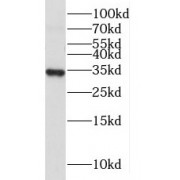 WB analysis of human heart tissue, using MRPL19 antibody (1/500 dilution).