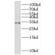 WB analysis of human liver tissue, using MRPL2 antibody (1/500 dilution).