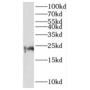 WB analysis of human heart tissue, using MRPL21 antibody (1/500 dilution).