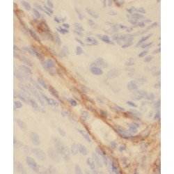 Mitochondrial Ribosomal Protein L27 (MRPL27) Antibody