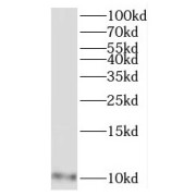 WB analysis of A431 cells, using MRPL27 antibody (1/300 dilution).