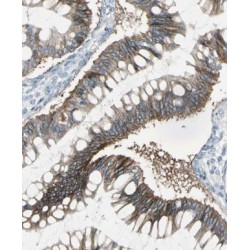 Mitochondrial Ribosomal Protein L45 (MRPL45) Antibody