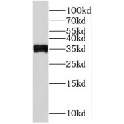 WB analysis of HeLa cells, using MRPL45 antibody (1/500 dilution).