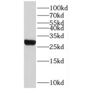 WB analysis of mouse testis tissue, using MRPL47 antibody (1/300 dilution).