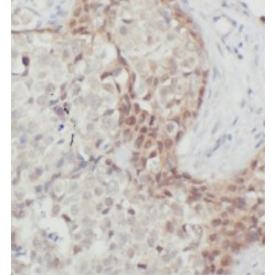 Mitochondrial Ribosomal Protein L9 (MRPL9) Antibody