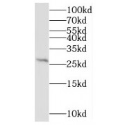 WB analysis of MCF7 cells, using MRPL9 antibody (1/500 dilution).