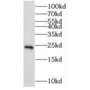 WB analysis of human brain tissue, using MRPS10 antibody (1/500 dilution).