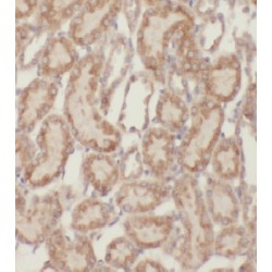 Mitochondrial Ribosomal Protein S11 (MRPS11) Antibody