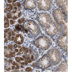 Mitochondrial Ribosomal Protein S2 (MRPS2) Antibody