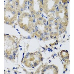 Mitochondrial Ribosomal Protein S22 (MRPS22) Antibody