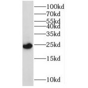 WB analysis of HeLa cells, using MRPS23 antibody (1/2000 dilution).