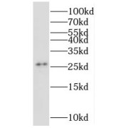 WB analysis of HeLa cells, using MRPS34 antibody (1/500 dilution).