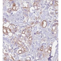 Mitochondrial Ribosome Recycling Factor (MRRF) Antibody