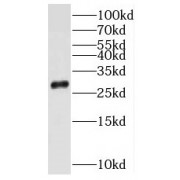 WB analysis of human lung tissue, using MRRF antibody (1/500 dilution).