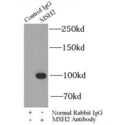 DNA Mismatch Repair Protein Msh2 (MSH2) Antibody